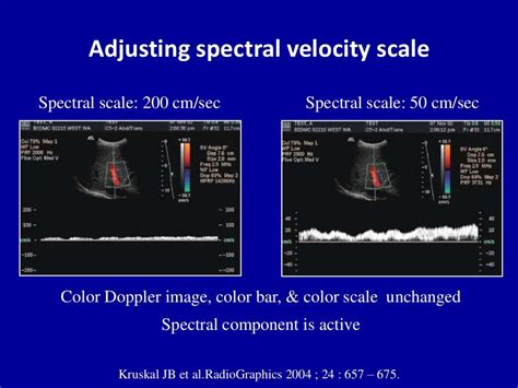 Principles Of Doppler Ultrasound