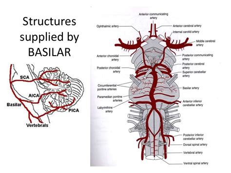 Posterior circulation stroke Syndromes