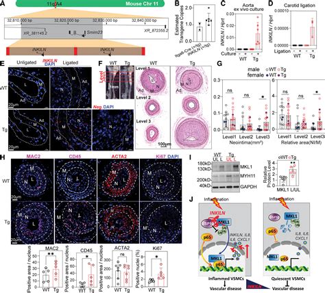 INKILN Is A Novel Long Noncoding RNA Promoting Vascular Smooth Muscle