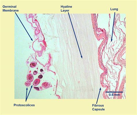 Echinococcus Canadensis Learn About Parasites Western College Of Veterinary Medicine