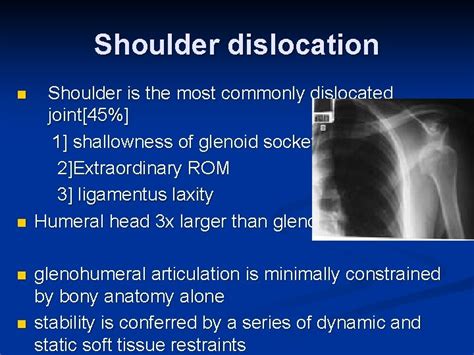 Shoulder Dislocation Types