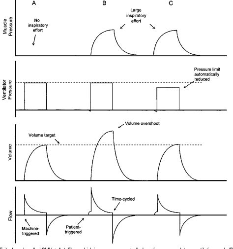 Ventilator Modes Conversion Chart