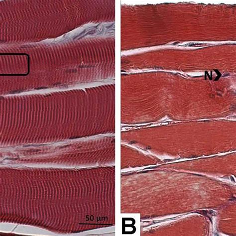 H E Stained Skeletal Muscle Sections At X Magnification Image A