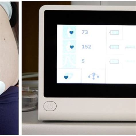 Non‐invasive Fetal Electrocardiography Ni‐fecg Electrode Patch And Download Scientific