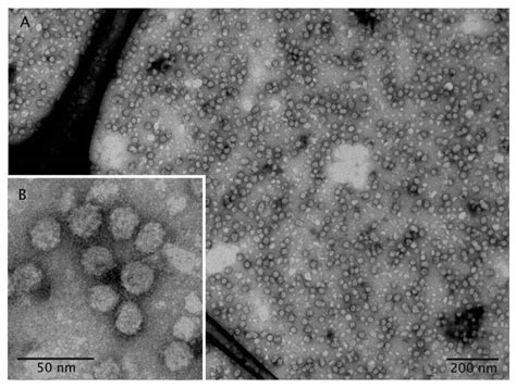 Mempro Virus Like Particles Vlps Production In Yeast Cells System