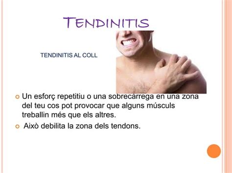 Fractures Luxacions Esquin Os I Tendinitis Violeta Santal Ppt