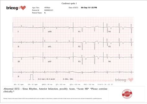 Campaign Ga Lead Ecg Machine Tricog Health