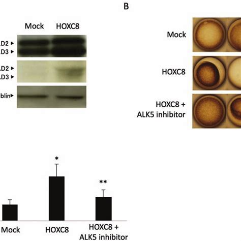 Activation of TGF β signaling by overexpression of HOXC8 A Western