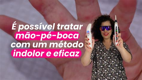 Tratando a Síndrome Mão Pé Boca o Laserterapia na pediatria YouTube