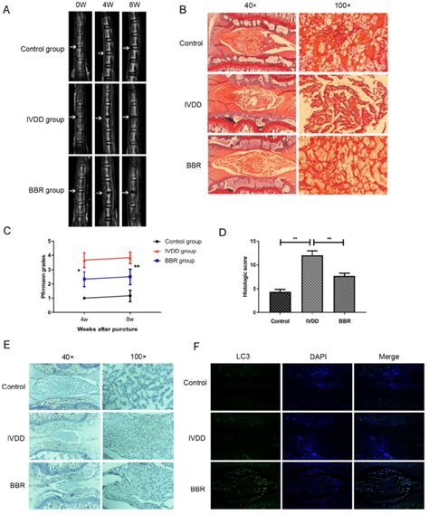 Bbr Ameliorates Ivdd Development In A Needle Puncture Induced Rat Model