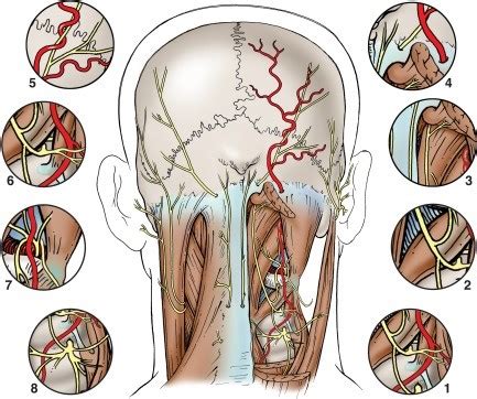 Occipital headaches and occipital neuralgia - Zeljko Kojadinovic, MD ...