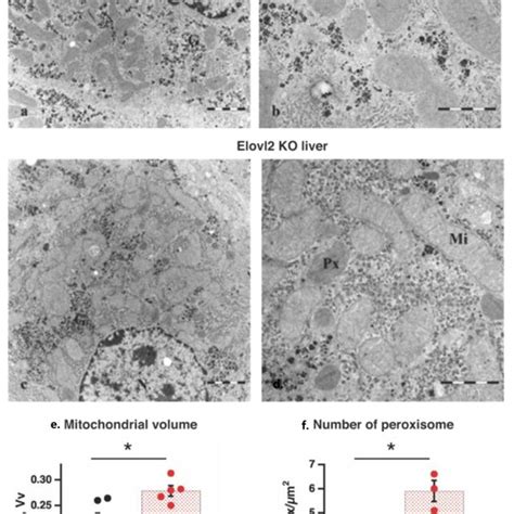 Morphology Of Liver Tissue By Electron Microscopy A D Transmission