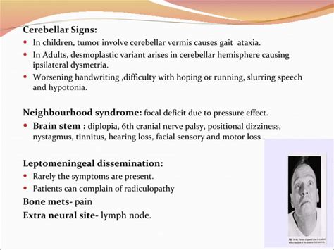 Diagnosis, Treatment & Management of Medulloblastoma