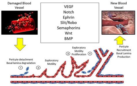 Angiogenesis And Angiogenesis Process In Cancer Wound Healing