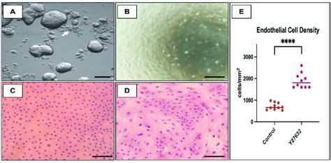 Human Cornea Endothelium Isolation And Attachment Cell Attachment