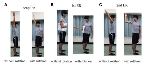 Anterior Shoulder Dislocation Exercises