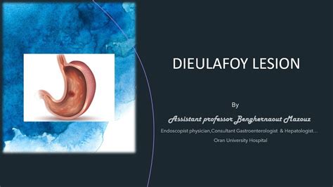 Dieulafoy Lesion Youtube