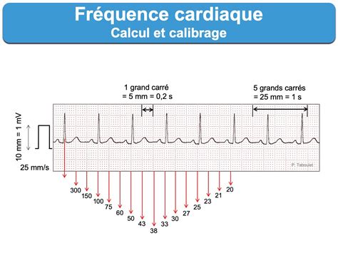 Fréquence cardiaque e cardiogram