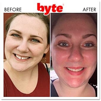 Byte Before & After Photos: Pics of Real Customer Results