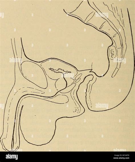 Anatomischer Anzeiger Stock Photo Alamy