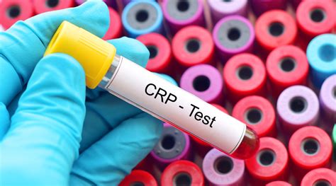 CRP Test: Here's Everything You Need to Know - HealthKart