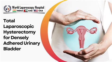 Mastering Tlh Complexity Total Laparoscopic Hysterectomy For Densely