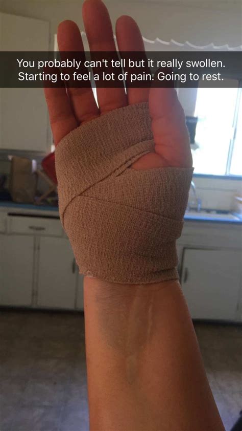 Carpal Tunnel Surgery Recovery 3 Months Later 247 Modern Mom™