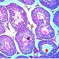 Transverse Section Of The Testicular Tissue For Male Rats Control