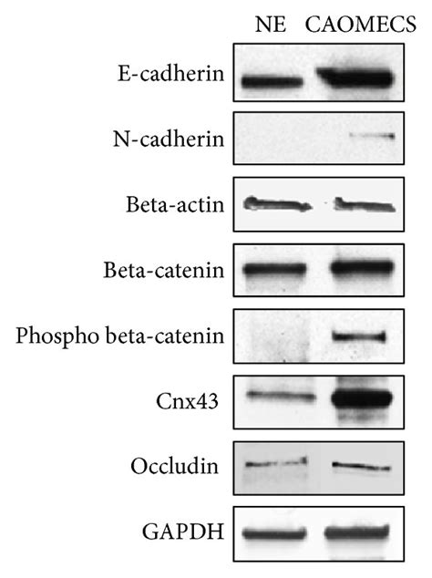 Western Blot Analysis Of E Cadherin And N Cadherin A Beta Catenin Download Scientific