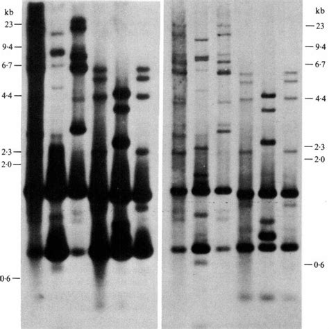 Southern Blot Analysis Of Restriction Endonuclease Digested P