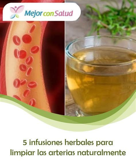 5 Infusiones Herbales Para Limpiar Las Arterias Naturalmente Mejor