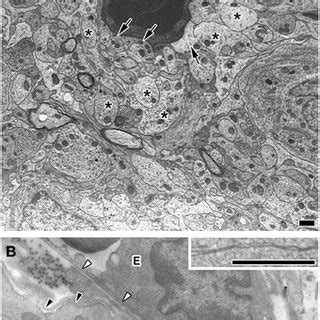 Electron micrographs showing coverage of fenestrated capillaries by... | Download Scientific Diagram