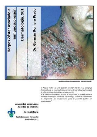 Herpes zoster asociado a inmunosupresión PDF