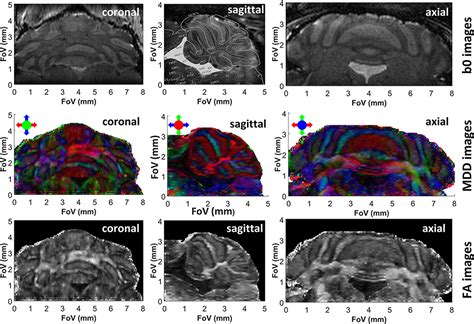 Frontiers High Resolution 3D In Vivo Brain Diffusion Tensor Imaging