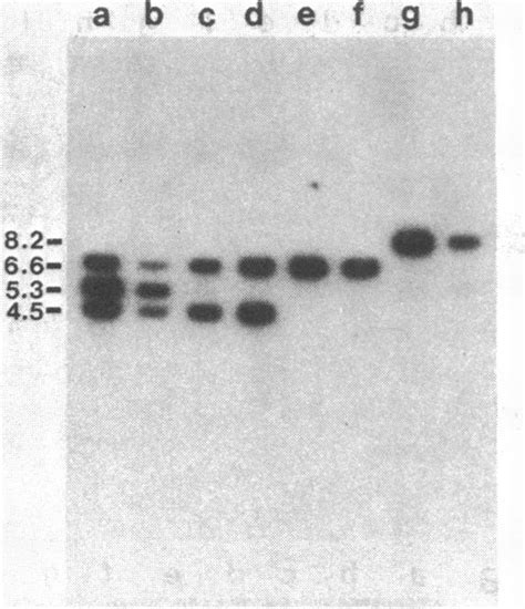 Comparison Of Plasmid Dnas And Total Cell Dnas From Four Strains By Download Scientific Diagram