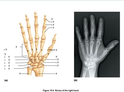 Hand Diagram Diagram | Quizlet