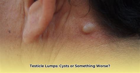 Scrotal Lumps and Bumps: Understanding Sebaceous Cysts in the Testicles