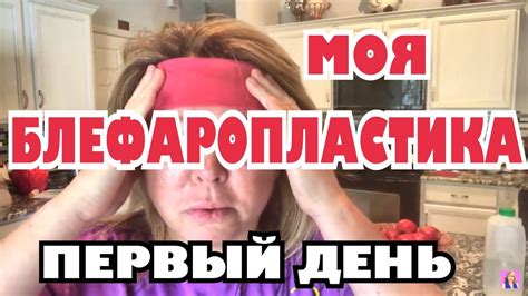 Моя блефаропластика не знаю как я это пережила Youtube