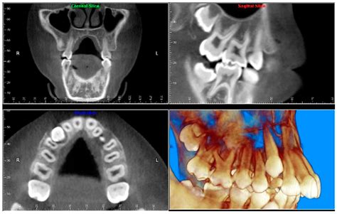 Describe The Purpose And Uses Of Cone Beam Computed Tomography