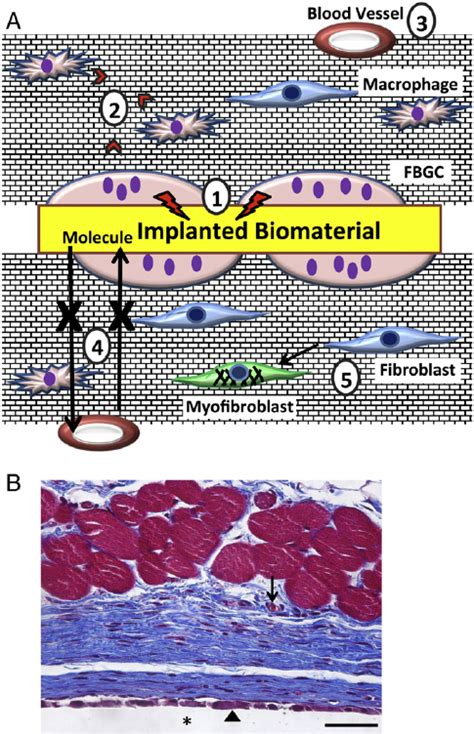 Overview Of The Foreign Body Response A Implantation Of Biomaterial Download Scientific