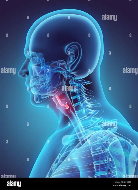 Epiglottis cancer hi-res stock photography and images - Alamy