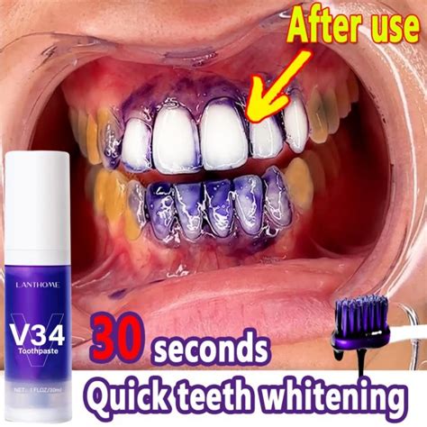 Dentes Roxos Whitening Creme Dental Esmalte Care Easy Smile Removal