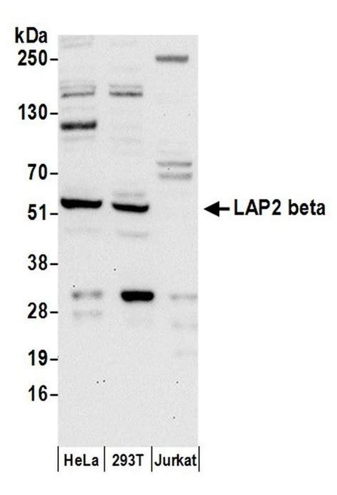 Lap2 Betatmpo Polyclonal Antibody A304 841a T