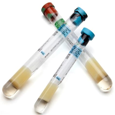 BD Vacutainer Glass Mononuclear Cell Preparation (CPT) Tubes:Blood ...