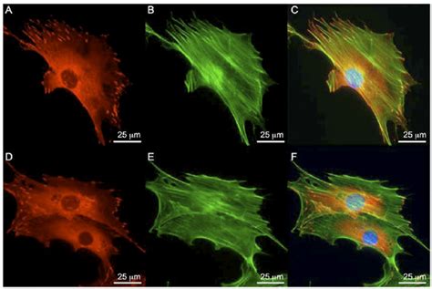 Focal Adhesion Formation And Actin Cytoskeleton In Wild Type And FAK 2