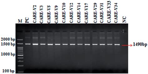 Agrose Gel Electrophoresis Of The S Rrna Gene Amplicons The Amplicon