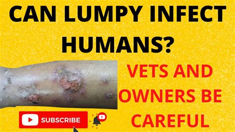 Could Lumpy Skin Disease Be The Next Big Human Threat YouTube