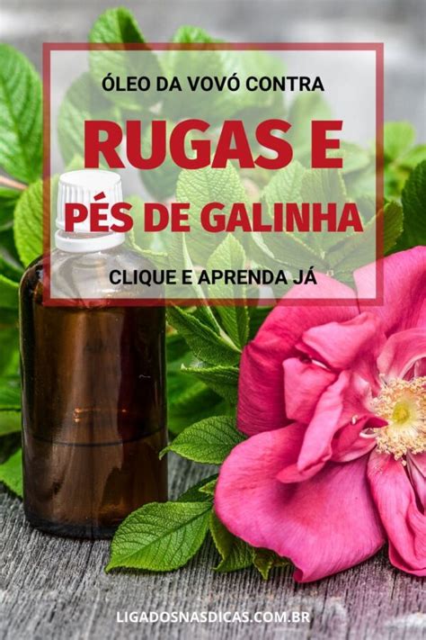 Tira Rugas E P S De Galinha Ligados Nas Dicas