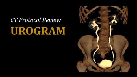 CT Urogram | Video Lesson | Clover Learning