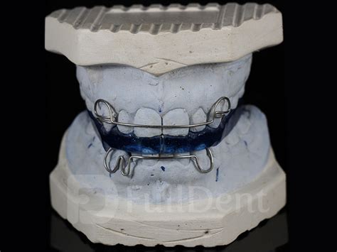 Orthodontics Full Dent